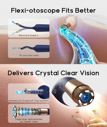 گوش پاک کن هوشمند شیائومی مدل Bebird Earsight Plus D39R Ear Wax Removal Tool